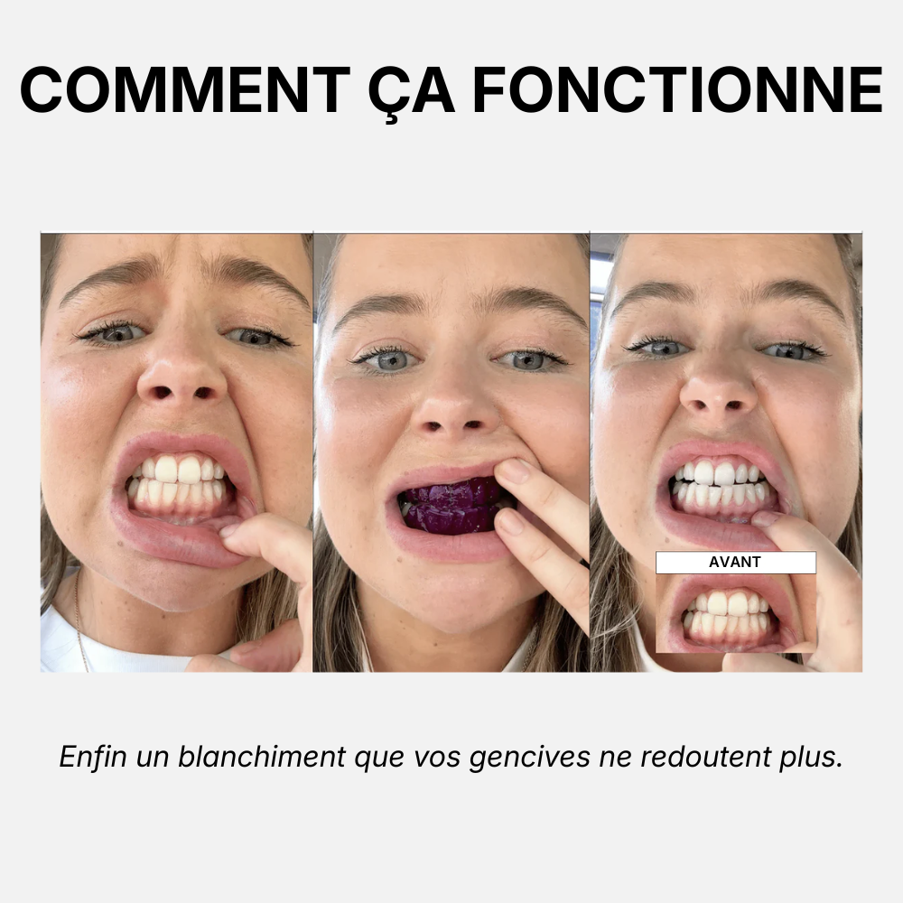 14 Bandes Blanchissantes