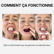 14 Bandes Blanchissantes