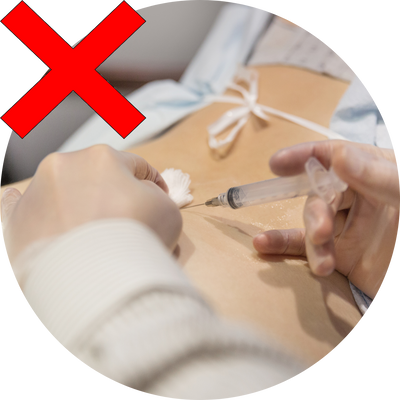 Cortisone injections